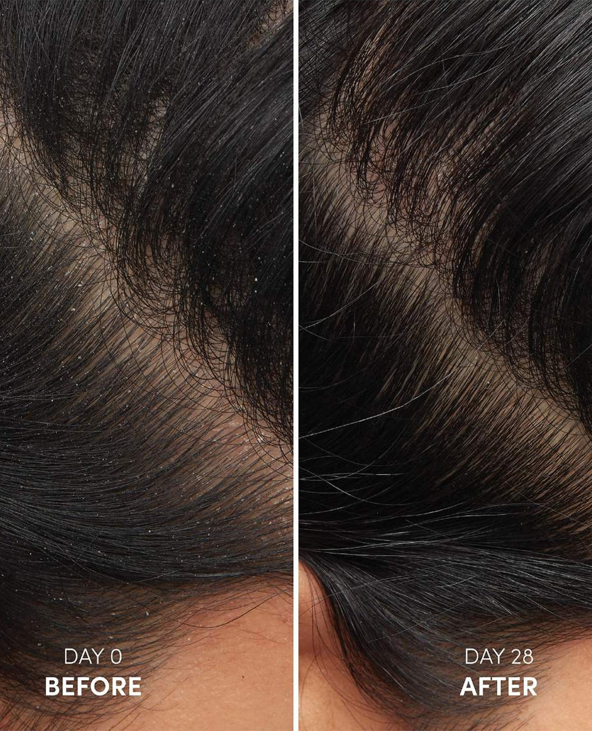OUAI Anti-Dandruff Shampoo details