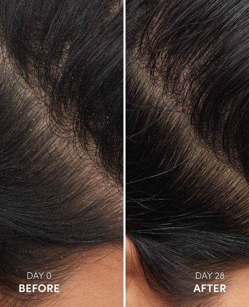 OUAI Anti-Dandruff Shampoo details