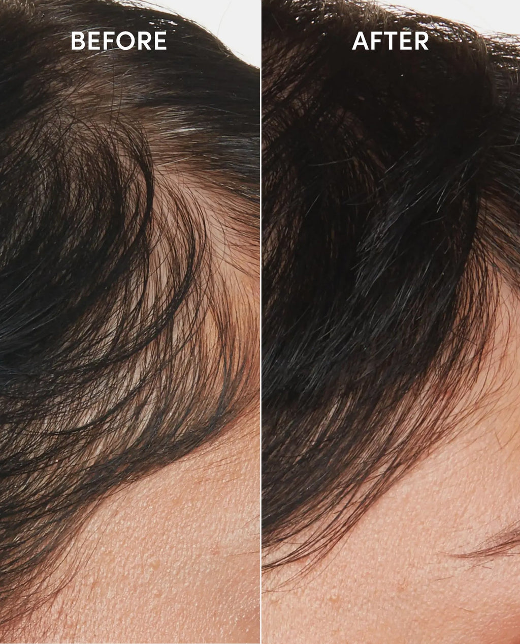 OUAI Scalp Serum lifestyle